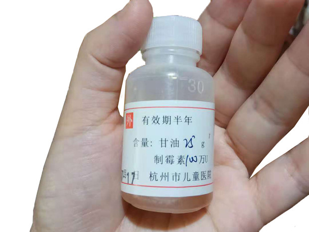 寶寶嘴里長(zhǎng)了白色斑點(diǎn)，很可能是鵝口瘡
